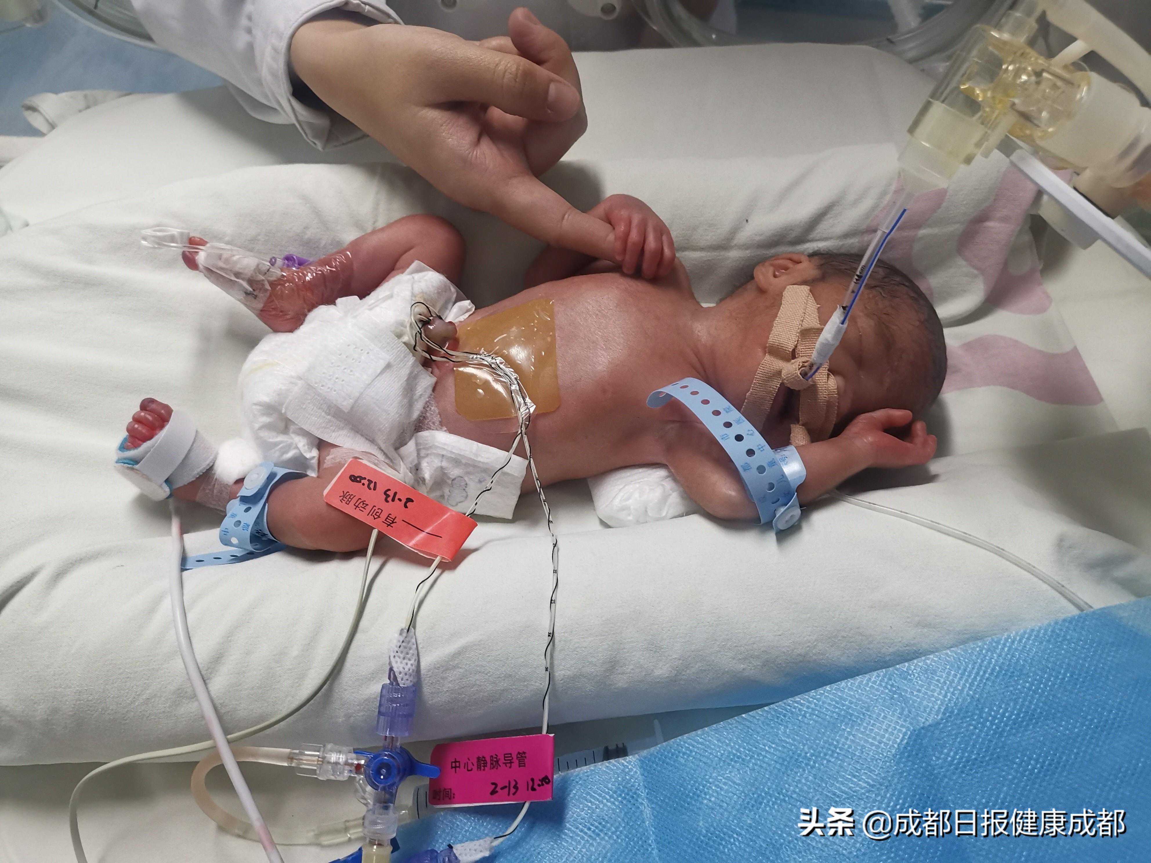 快救胎儿！香港夫妇7次试管婴儿终获成功，成都探亲却突发状况